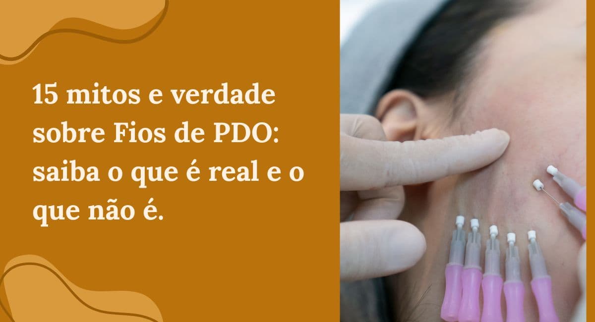 15 Mitos e Verdades Sobre os Fios de PDO: Saiba o que é Real e o que Não É
