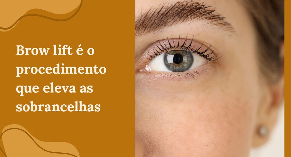 Brow Lift: O Procedimento que Eleva as Sobrancelhas