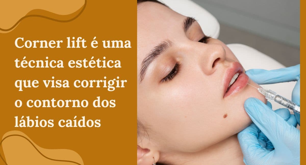 Corner Lift: A Técnica para Elevar os Cantos da Boca Caídos