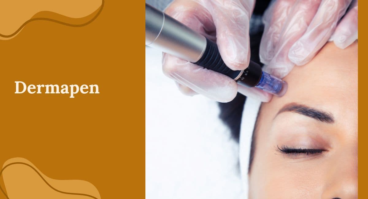 Dermapen (Microagulhamento): Como Furos Invisíveis Curam Cicatrizes