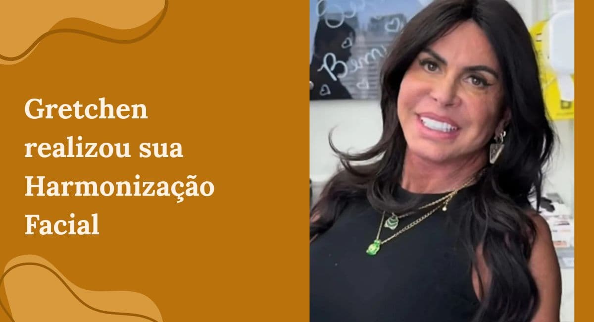 Harmonização Facial da Gretchen: Uma Análise Estética e os Perigos do Exagero
