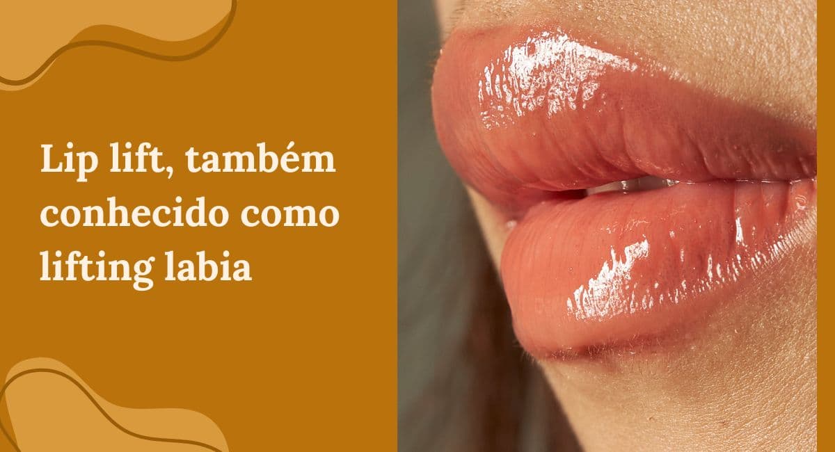 Lip Lift (Lifting Labial): A Cirurgia que Encurta e Rejuvenesce a Boca