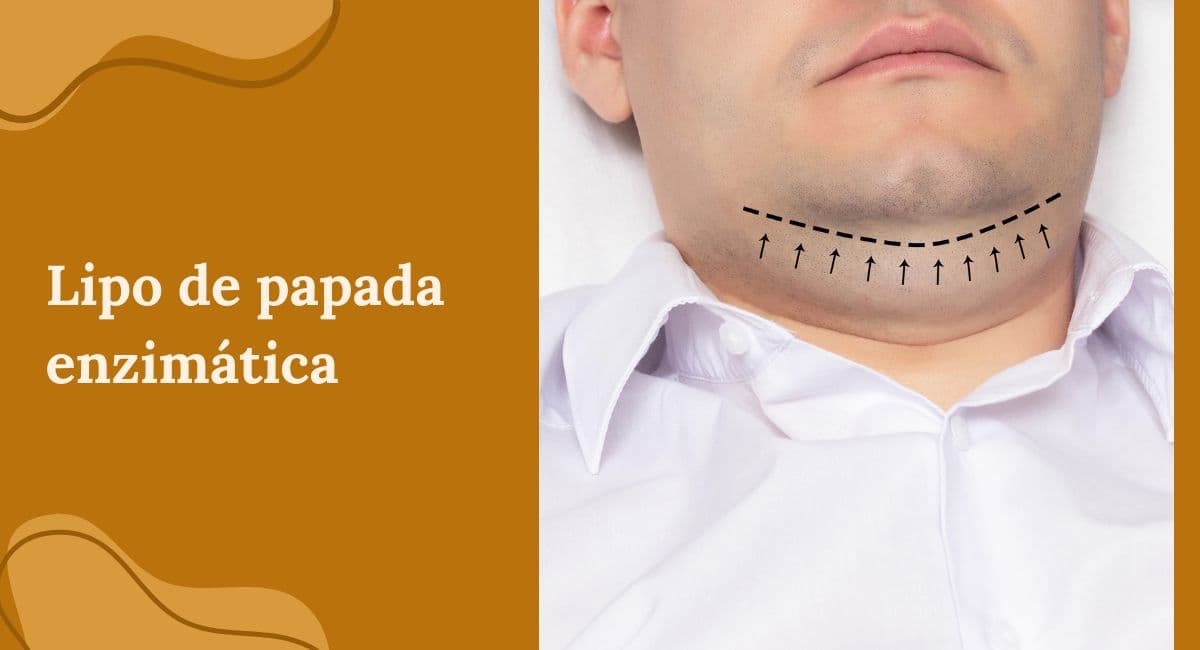 Lipo de Papada Mecânica vs. Enzimática: Qual a Escolha Certa Para Você?