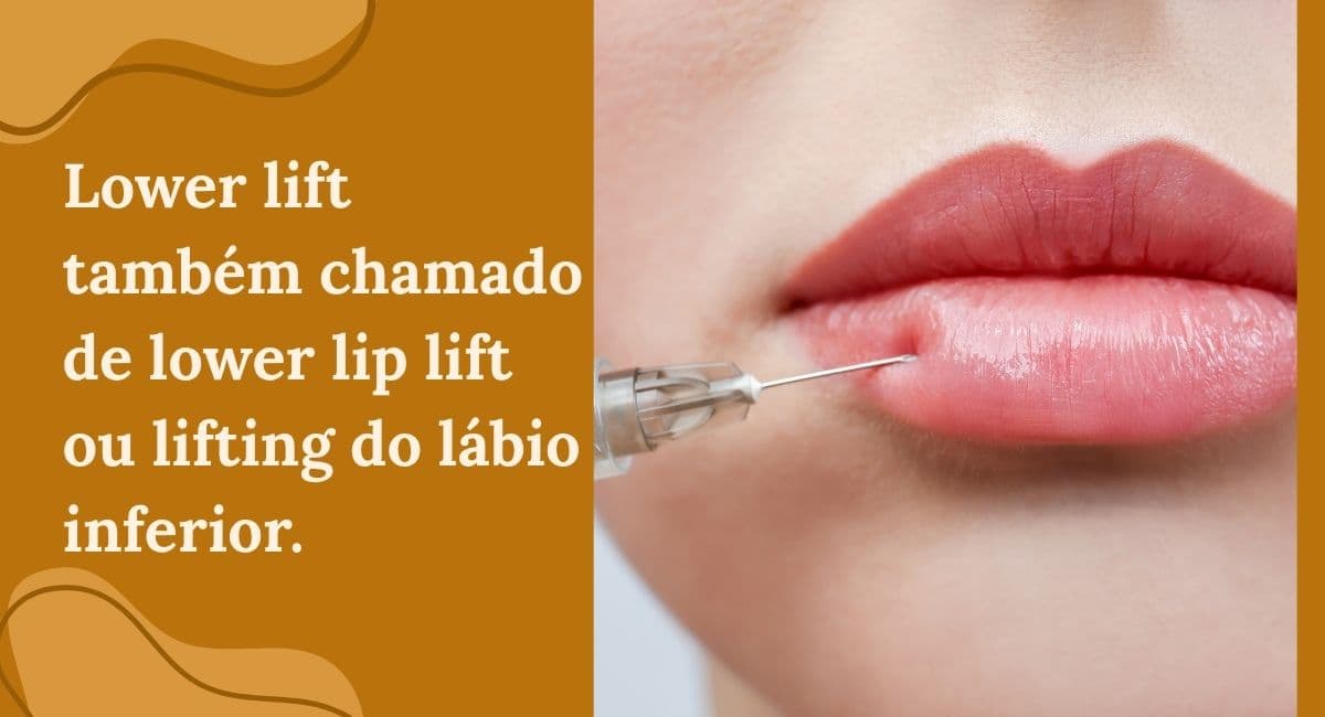 Lower Lip Lift: A Técnica Desconhecida para o Lábio Inferior