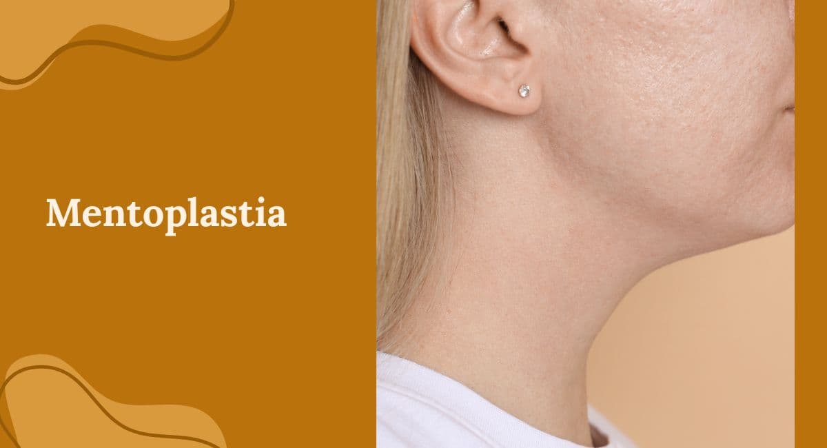Mentoplastia Cirúrgica x Preenchimento de Mento: Qual a Melhor Opção?