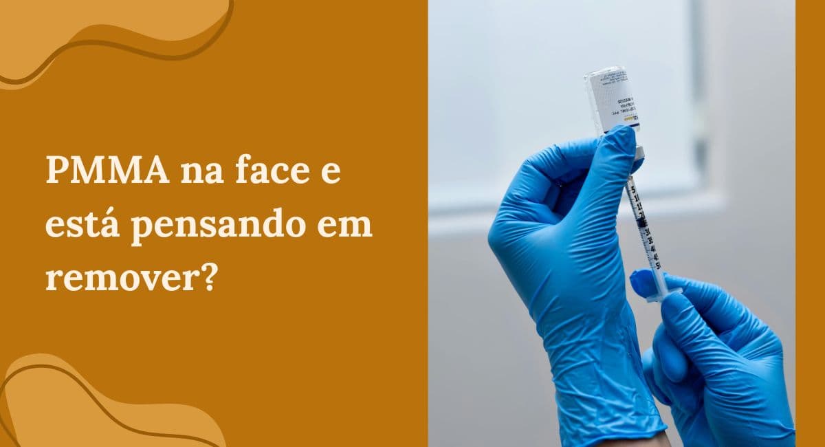 PMMA na Face e os Perigos do Preenchimento Definitivo: É Possível Remover?