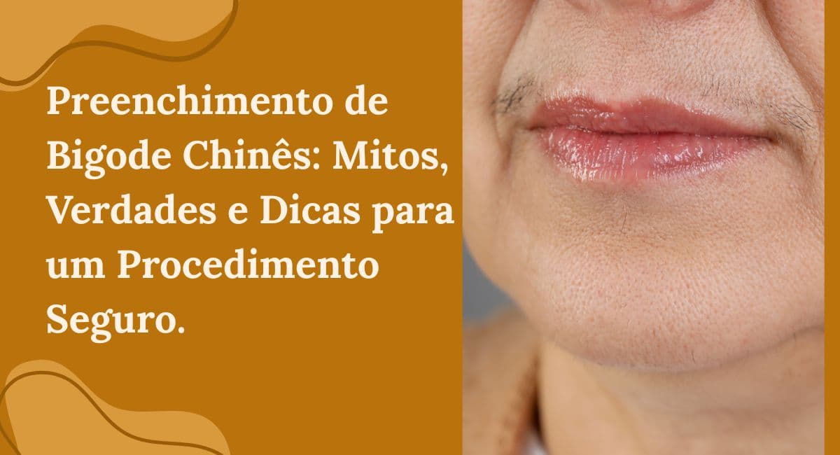 Preenchimento de Bigode Chinês: Mitos, Verdades e Dicas para um Procedimento Seguro