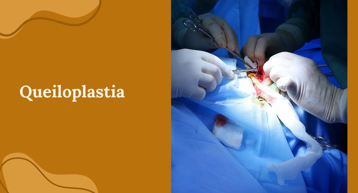Queiloplastia: A Cirurgia Plástica Labial e suas Indicações