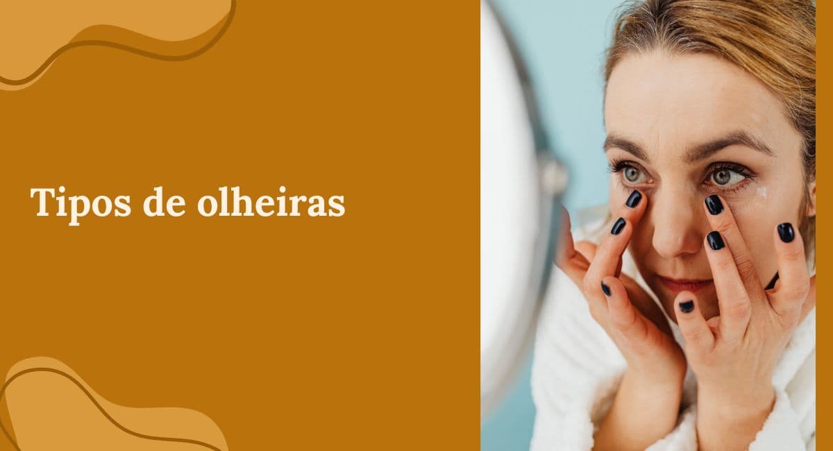 Tipos de Olheiras: Descubra qual é a sua e qual o tratamento correto