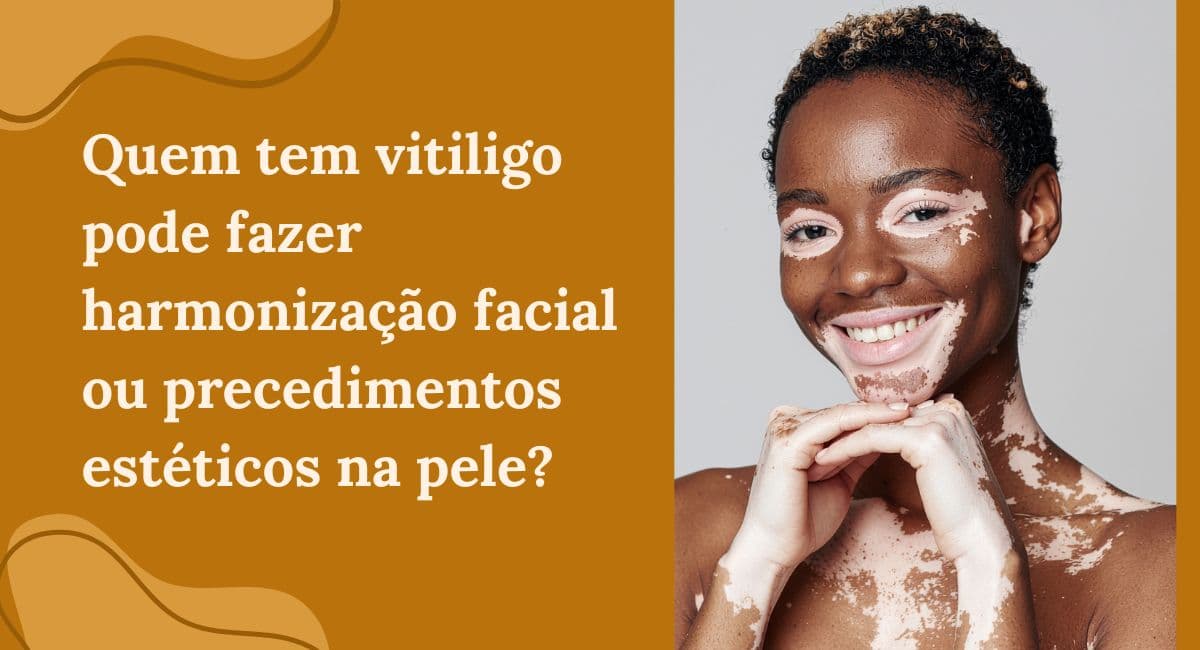 Quem tem Vitiligo pode fazer Harmonização Facial ou Procedimentos Estéticos?
